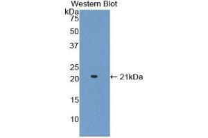 Detection of Recombinant ADAMTS2, Mouse using Polyclonal Antibody to A Disintegrin And Metalloproteinase With Thrombospondin 2 (ADAMTS2) (Adamts2 antibody  (AA 855-1030))