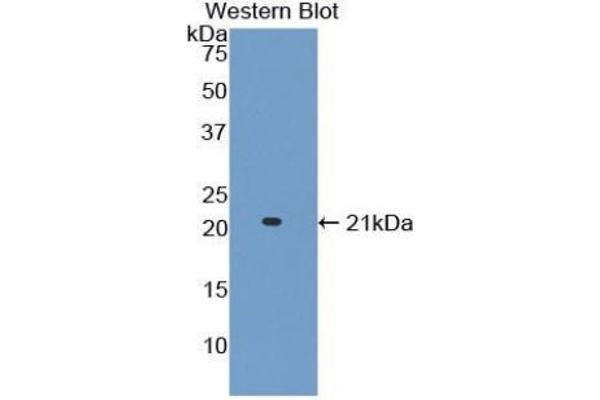 Adamts2 anticorps  (AA 855-1030)