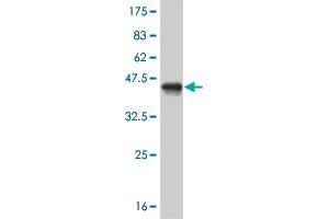 Western Blot detection against Immunogen (41. (MED21 antibody  (AA 1-144))