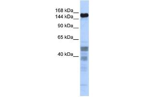 WB Suggested Anti-ZNF335 Antibody Titration:  0. (ZNF335 antibody  (Middle Region))