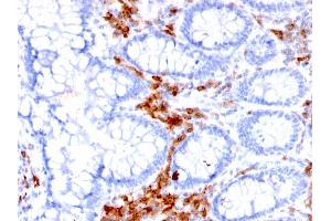 Immunohistochemistry (IHC) image for anti-CD27 Molecule (CD27) antibody (ABIN6941124)