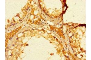 Immunohistochemistry of paraffin-embedded human testis tissue using ABIN7152406 at dilution of 1:100 (FBXO15 antibody  (AA 201-434))