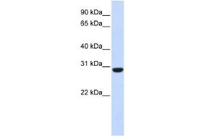 WB Suggested Anti-RCAN1 Antibody Titration:  0. (RCAN1 antibody  (Middle Region))