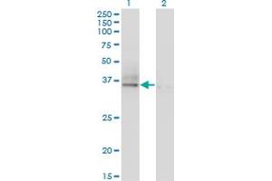 Western Blot analysis of ASGR2 expression in transfected 293T cell line by ASGR2 monoclonal antibody (M05), clone 1D7. (Asialoglycoprotein Receptor 2 antibody  (AA 1-287))