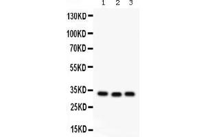 Western blot analysis of GC1q R expression in rat liver extract ( Lane 1), mouse spleen extract ( Lane 2) and MCF-7 whole cell lysates ( Lane 3). (C1QBP antibody  (AA 190-282))