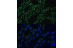 Immunofluorescence analysis of C6 cells using  Polyclonal Antibody (ABIN7265509) at dilution of 1:100 (40x lens). (AEBP1 antibody  (AA 999-1158))