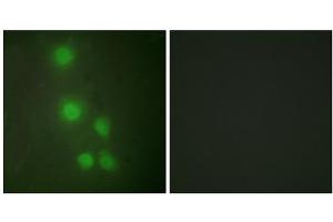 Immunofluorescence analysis of HUVEC cells, using ACL6A antibody. (BAF53A antibody  (Internal Region))
