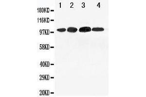 Anti-Mineralocorticoid Receptor antibody, Western blotting Lane 1: 293T Cell Lysate Lane 2: SMMC Cell Lysate Lane 3: SW620 Cell Lysate Lane 4: HELA Cell Lysate