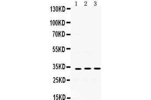 Western Blotting (WB) image for anti-Superoxide Dismutase 3, Extracellular (SOD3) (AA 37-75), (N-Term) antibody (ABIN3043936)