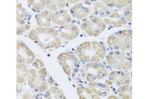 Immunohistochemistry of paraffin-embedded Human stomach using DISC1 Polyclonal Antibody at dilution of 1:100 (40x lens). (DISC1 antibody)