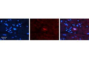 Rabbit Anti-JUNB Antibody   Formalin Fixed Paraffin Embedded Tissue: Human heart Tissue Observed Staining: Nucleus Primary Antibody Concentration: 1:100 Other Working Concentrations: N/A Secondary Antibody: Donkey anti-Rabbit-Cy3 Secondary Antibody Concentration: 1:200 Magnification: 20X Exposure Time: 0.
