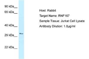 Host: Rabbit Target Name: RNF167 Sample Type: Jurkat Whole Cell lysates Antibody Dilution: 1. (RNF167 antibody  (C-Term))