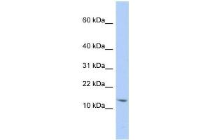 SNRPD2 antibody used at 1 ug/ml to detect target protein.
