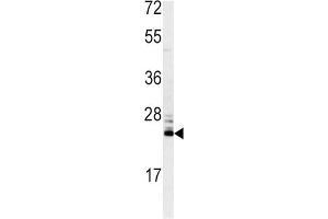 Western Blotting (WB) image for anti-Methionine Sulfoxide Reductase A (MSRA) antibody (ABIN3003138) (MSRA antibody)