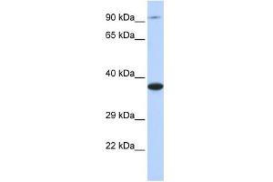 BBS5 antibody used at 1 ug/ml to detect target protein. (BBS5 antibody  (Middle Region))