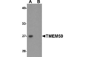 Western Blotting (WB) image for anti-Transmembrane Protein 59 (TMEM59) (N-Term) antibody (ABIN1031631)