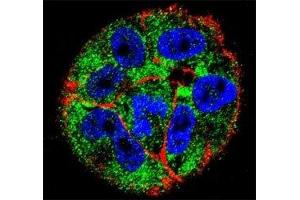 Immunofluorescence (IF) image for anti-Tumor Protein P53 (TP53) (AA 1-30) antibody (ABIN3029383)