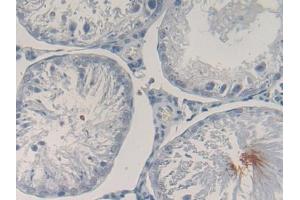 DAB staining on IHC-P; Samples: Rat Testis Tissue (POMC antibody  (AA 27-235))