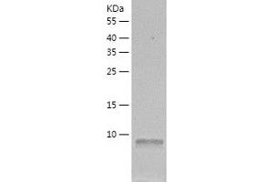DYNLRB1 Protein (AA 1-96) (His tag)