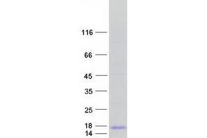 Validation with Western Blot (FXYD3 Protein (Transcript Variant 1) (Myc-DYKDDDDK Tag))