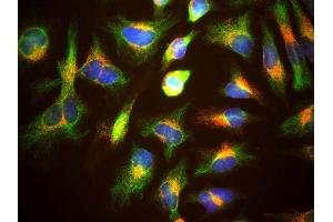 HeLa cells staining with ABIN1580431 (red), and counterstained with chicken polyclonal antibody to Vimentin CPCA-Vim (green) and DNA (blue). (LAMP1 antibody)