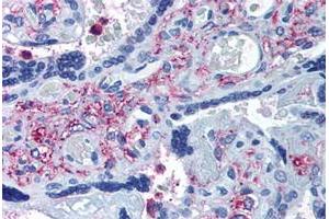 Immunohistochemical staining of human placenta with ADAMTS5 polyclonal antibody . (ADAMTS5 antibody  (Internal Region))