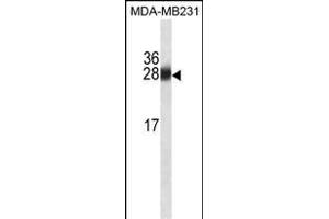 GSTM1 Antibody ABIN1539938 western blot analysis in MDA-M cell line lysates (35 μg/lane). (GSTM1 antibody  (AA 184-211))