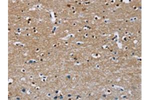 The image on the left is immunohistochemistry of paraffin-embedded Human brain tissue using ABIN7130272(MSH5 Antibody) at dilution 1/30, on the right is treated with fusion protein. (MSH5 antibody)