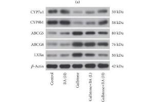 Lithogenic diet induced disorders of cholesterol synthesis and transport in liver. (ABCG5 antibody  (AA 350-450))