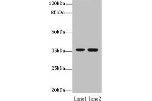 Western blot All lanes: EEF2KMT antibody at 6 μg/mL Lane 1: Hela whole cell lysate Lane 2: 293T whole cell lysate Secondary Goat polyclonal to rabbit IgG at 1/10000 dilution Predicted band size: 37, 34 kDa Observed band size: 37 kDa (EEF2KMT (AA 1-330) antibody)