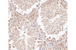 Immunohistochemistry of paraffin-embedded Mouse testis using VEGF Receptor 2 Polyclonal Antibody at dilution of 1:100 (40x lens). (VEGFR2/CD309 antibody)