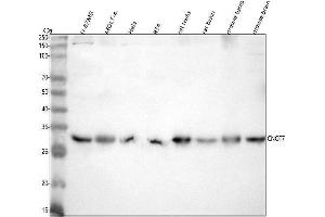Western blot analysis of CNOT7 using anti-CNOT7 antibody (ABIN7601184).