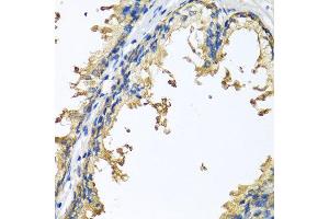 Immunohistochemistry of paraffin-embedded human prostate using NLGN4Y antibody at dilution of 1:100 (x40 lens). (Neuroligin Y antibody)