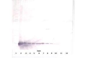 Image no. 2 for anti-gamma-Interferon-Induced Monokine (CXCL9) antibody (ABIN465878) (CXCL9 antibody)
