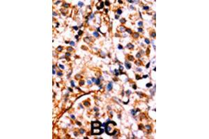 Immunohistochemistry (IHC) image for anti-Nuclear Factor kappa B (NFkB) (pSer536) antibody (ABIN3001768)