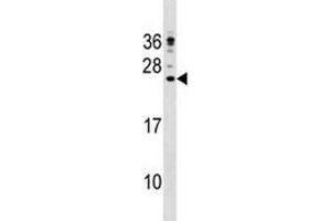 CAMP antibody western blot analysis in NCI-H292 lysate (Cathelicidin antibody  (AA 123-152))