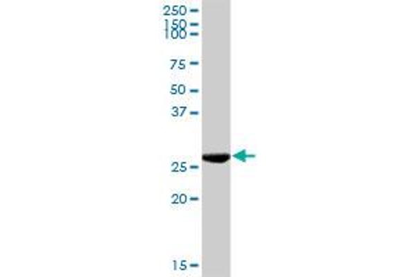 Ketohexokinase antibody  (AA 1-298)