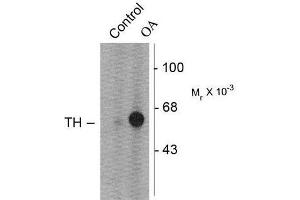 Image no. 1 for anti-Tyrosine Hydroxylase (TH) (pSer31) antibody (ABIN372737) (Tyrosine Hydroxylase antibody  (pSer31))