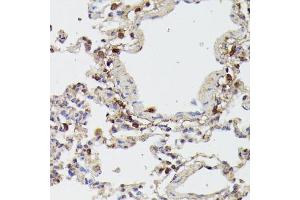 Immunohistochemistry (IHC) image for anti-Receptor (TNFRSF)-Interacting serine-threonine Kinase 1 (RIPK1) (AA 170-440) antibody (ABIN6146959)