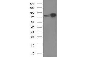 HEK293T cells were transfected with the pCMV6-ENTRY control (Left lane) or pCMV6-ENTRY CTNNB1 (Right lane) cDNA for 48 hrs and lysed. (CTNNB1 antibody)