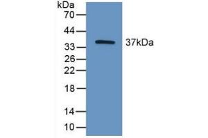 Detection of Recombinant HIF2a, Mouse using Polyclonal Antibody to Hypoxia Inducible Factor 2 Alpha (HIF2a) (EPAS1 antibody  (AA 21-336))