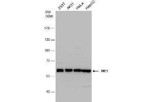 WB Image ME1 antibody detects ME1 protein by western blot analysis.