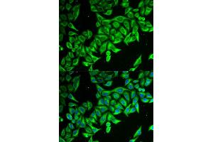 Immunofluorescence (IF) image for anti-Death-Associated Protein (DAP) antibody (ABIN1877136)