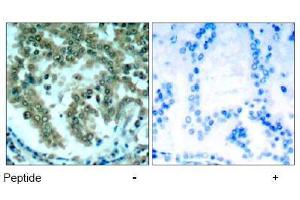 Image no. 1 for anti-Protein Kinase C, theta (PRKCQ) (AA 674-678) antibody (ABIN197567) (PKC theta antibody  (AA 674-678))