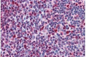 Human Tonsil: Formalin-Fixed, Paraffin-Embedded (FFPE) (CHD4 antibody  (AA 71-120))
