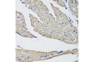 Immunohistochemistry (IHC) image for anti-SET and MYND Domain Containing 1 (SMYD1) (AA 1-350) antibody (ABIN6148163)