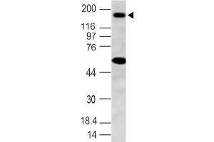 Image no. 1 for anti-NLR Family, Pyrin Domain Containing 3 (NLRP3) (AA 150-385) antibody (ABIN5027385) (NLRP3 antibody  (AA 150-385))