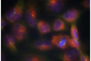 Image no. 1 for anti-Microtubule-Associated Protein tau (MAPT) (Ser356) antibody (ABIN401616) (MAPT antibody  (Ser356))