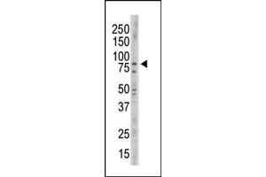 Image no. 1 for anti-NIMA (Never In Mitosis Gene A)-Related Kinase 11 (NEK11) (C-Term) antibody (ABIN360534) (NEK11 antibody  (C-Term))