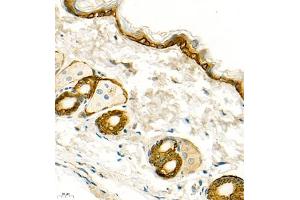 Immunohistochemistry of paraffin embedded mouse skin using CK13 (ABIN7074412) at dilution of 1:1500 (400x lens)